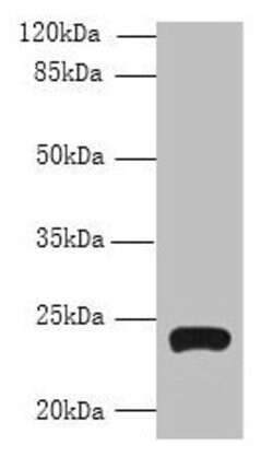 Invitrogen TMEM222 Polyclonal Antibody 100 &mu;g; Unconjugated:Antibodies,