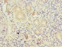 Invitrogen TM41A Polyclonal Antibody 100 &mu;g; Unconjugated:Antibodies,