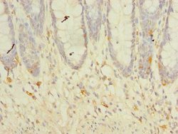 Invitrogen TM41A Polyclonal Antibody 100 &mu;g; Unconjugated:Antibodies,