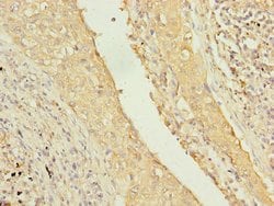 Invitrogen TMEM55A Polyclonal Antibody 100 &mu;g; Unconjugated:Antibodies,