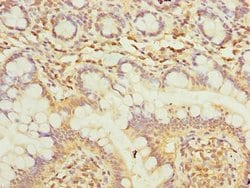 Invitrogen TMEM55A Polyclonal Antibody 100 &mu;g; Unconjugated:Antibodies,