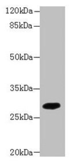 Invitrogen TMEM55A Polyclonal Antibody 100 &mu;g; Unconjugated:Antibodies,