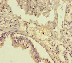 TMEM64 Polyclonal Antibody:Antibodies, Polyclonal