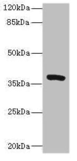 TMEM64 Polyclonal Antibody:Antibodies, Polyclonal