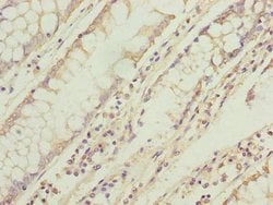 Invitrogen TMEM71 Polyclonal Antibody 100 &mu;g; Unconjugated:Antibodies,