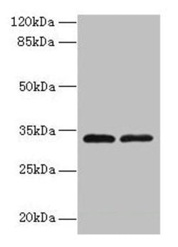 Invitrogen TMEM71 Polyclonal Antibody 100 &mu;g; Unconjugated:Antibodies,