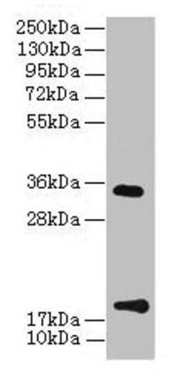 Invitrogen TMEM91 Polyclonal Antibody 100 &mu;g; Unconjugated:Antibodies,