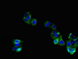 TNMD Polyclonal Antibody:Antibodies, Polyclonal