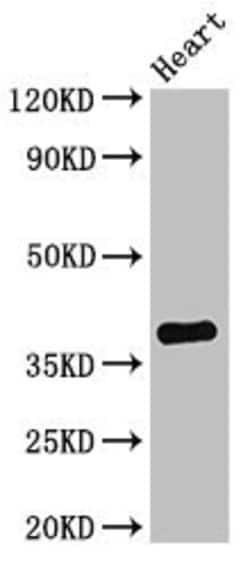 TNMD Polyclonal Antibody:Antibodies, Polyclonal
