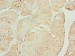 Invitrogen TNNI2 Polyclonal Antibody 100 &mu;L; Unconjugated:Antibodies,