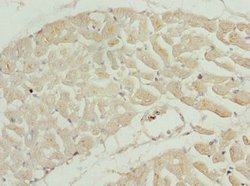 Invitrogen TNNI2 Polyclonal Antibody 100 &mu;L; Unconjugated:Antibodies,