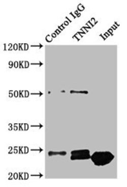 Invitrogen TNNI2 Polyclonal Antibody 100 &mu;L; Unconjugated:Antibodies,