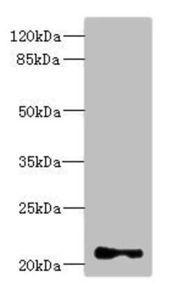 Invitrogen TNNI2 Polyclonal Antibody 100 &mu;L; Unconjugated:Antibodies,
