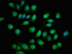 Invitrogen TOB1 Polyclonal Antibody 100 &mu;g; Unconjugated:Antibodies,