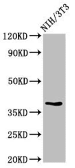 Invitrogen TOB1 Polyclonal Antibody 100 &mu;g; Unconjugated:Antibodies,