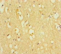 Invitrogen TOX3 Polyclonal Antibody 100 &mu;g; Unconjugated:Antibodies,