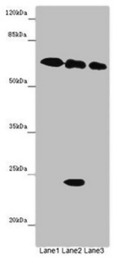 Invitrogen TOX3 Polyclonal Antibody 100 &mu;g; Unconjugated:Antibodies,