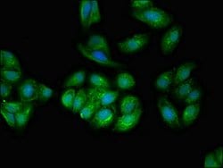 Invitrogen TPD52L2 Polyclonal Antibody 100 μg; Unconjugated:Antibodies,