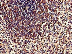 Invitrogen TPD52L2 Polyclonal Antibody 100 μg; Unconjugated:Antibodies,
