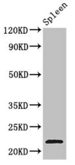 Invitrogen TPD52L2 Polyclonal Antibody 100 μg; Unconjugated:Antibodies,