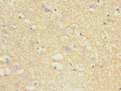 Invitrogen TPPP Polyclonal Antibody 100 μL; Unconjugated:Antibodies,