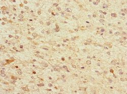 Invitrogen TPPP Polyclonal Antibody 100 μL; Unconjugated:Antibodies,