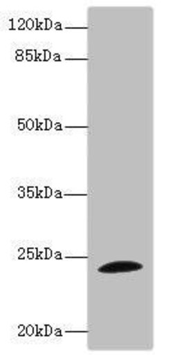 Invitrogen TPPP Polyclonal Antibody 100 μL; Unconjugated:Antibodies,