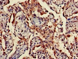 Invitrogen TPST1 Polyclonal Antibody 100 μg; Unconjugated:Antibodies,