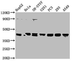 Invitrogen TPST1 Polyclonal Antibody 100 μg; Unconjugated:Antibodies,