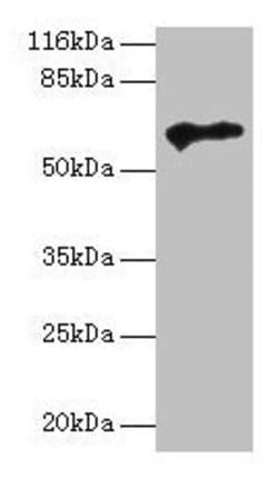 Invitrogen PTEN2 Polyclonal Antibody 100 μg; Unconjugated:Antibodies,