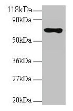 Invitrogen RPL15 Polyclonal Antibody 100 &mu;g | Buy Online | Invitrogen&trade; | Fisher Scientific