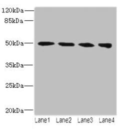 TUBB2A Polyclonal Antibody:Antibodies, Polyclonal