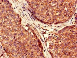Invitrogen USP6 Polyclonal Antibody 100 &mu;g | Buy Online | Invitrogen&trade; | Fisher Scientific