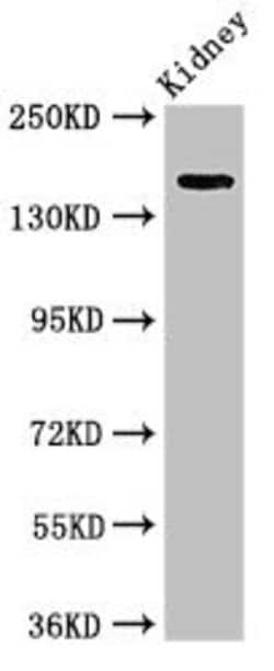 Invitrogen USP6 Polyclonal Antibody 100 &mu;g | Buy Online | Invitrogen&trade; | Fisher Scientific
