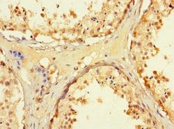 Invitrogen WRB Polyclonal Antibody 100 μg; Unconjugated:Antibodies,
