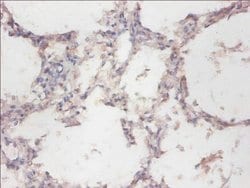 Invitrogen CYB5R3 Polyclonal Antibody 100 &mu;g; Unconjugated:Antibodies,