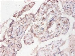 Invitrogen CYB5R3 Polyclonal Antibody 100 &mu;g; Unconjugated:Antibodies,