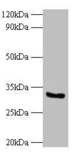 Invitrogen CYB5R3 Polyclonal Antibody 100 &mu;g; Unconjugated:Antibodies,
