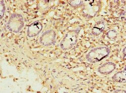 ZNF19 Polyclonal Antibody, Invitrogen 100 &mu;g; Unconjugated:Antibodies,