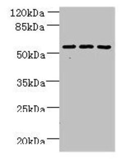 ZNF19 Polyclonal Antibody, Invitrogen 100 &mu;g; Unconjugated:Antibodies,