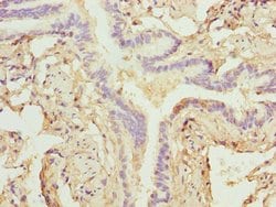 Invitrogen ZNF212 Polyclonal Antibody 100 &mu;g | Buy Online | Invitrogen&trade; | Fisher Scientific
