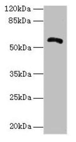 Invitrogen ZNF238 Polyclonal Antibody 100 &mu;g; Unconjugated:Antibodies,