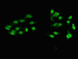 Invitrogen ZNF331 Polyclonal Antibody 100 &mu;g; Unconjugated:Antibodies,