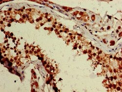 Invitrogen ZNF331 Polyclonal Antibody 100 &mu;g; Unconjugated:Antibodies,