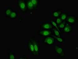Invitrogen ZNF529 Polyclonal Antibody 100 &mu;g; Unconjugated:Antibodies,
