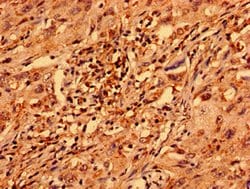 Invitrogen ZNF529 Polyclonal Antibody 100 &mu;g; Unconjugated:Antibodies,
