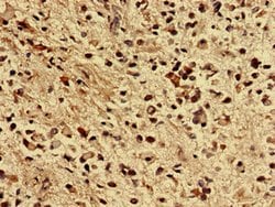 Invitrogen ZNF529 Polyclonal Antibody 100 &mu;g; Unconjugated:Antibodies,