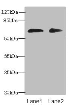 Invitrogen ZNF529 Polyclonal Antibody 100 &mu;g; Unconjugated:Antibodies,