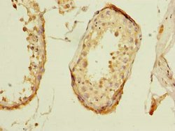 Invitrogen ZNF614 Polyclonal Antibody 100 &mu;g | Buy Online | Invitrogen&trade; | Fisher Scientific