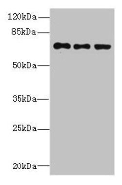 Invitrogen ZNF614 Polyclonal Antibody 100 &mu;g | Buy Online | Invitrogen&trade; | Fisher Scientific